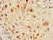 Coagulation Factor VIII antibody, LS-C395862, Lifespan Biosciences, Immunohistochemistry paraffin image 