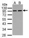 Actinin Alpha 3 (Gene/Pseudogene) antibody, GTX103216, GeneTex, Western Blot image 