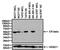 Estrogen Receptor 2 antibody, PA1-310B, Invitrogen Antibodies, Western Blot image 