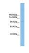 Coatomer Protein Complex Subunit Gamma 1 antibody, NBP1-57624, Novus Biologicals, Western Blot image 