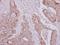 Asparaginyl-TRNA Synthetase 2, Mitochondrial antibody, GTX118096, GeneTex, Immunohistochemistry paraffin image 