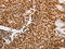 THO Complex 7 antibody, CSB-PA154285, Cusabio, Immunohistochemistry paraffin image 