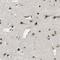 Lysine Demethylase 7A antibody, NBP1-81382, Novus Biologicals, Immunohistochemistry paraffin image 