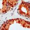 Fas Ligand antibody, ab15285, Abcam, Immunohistochemistry paraffin image 