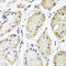 Heterogeneous Nuclear Ribonucleoprotein L antibody, STJ110728, St John
