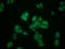 Interleukin 1 Receptor Accessory Protein Like 1 antibody, LS-C673742, Lifespan Biosciences, Immunofluorescence image 