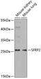 Secreted Frizzled Related Protein 2 antibody, 19-630, ProSci, Western Blot image 