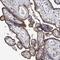 Taspase 1 antibody, NBP1-88307, Novus Biologicals, Immunohistochemistry paraffin image 