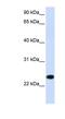 Paired Immunoglobin Like Type 2 Receptor Beta antibody, NBP1-62359, Novus Biologicals, Western Blot image 