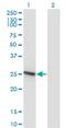 RAB32, Member RAS Oncogene Family antibody, H00010981-M01, Novus Biologicals, Western Blot image 