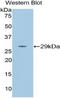 Matrix Metallopeptidase 16 antibody, LS-C295319, Lifespan Biosciences, Western Blot image 