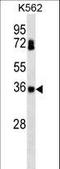 Casein Kinase 2 Beta antibody, LS-C167092, Lifespan Biosciences, Western Blot image 