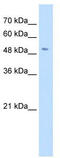 Solute Carrier Family 18 Member A2 antibody, TA334042, Origene, Western Blot image 