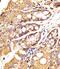 Epithelial Cell Adhesion Molecule antibody, A00276, Boster Biological Technology, Immunohistochemistry paraffin image 