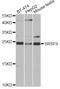 Serine And Arginine Rich Splicing Factor 9 antibody, LS-C747637, Lifespan Biosciences, Western Blot image 