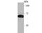 SAM And HD Domain Containing Deoxynucleoside Triphosphate Triphosphohydrolase 1 antibody, A00592-3, Boster Biological Technology, Western Blot image 