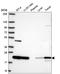 SRI antibody, HPA073666, Atlas Antibodies, Western Blot image 