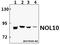 Nucleolar Protein 10 antibody, A14358-1, Boster Biological Technology, Western Blot image 