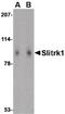 SLIT and NTRK-like protein 1 antibody, PA5-20470, Invitrogen Antibodies, Western Blot image 