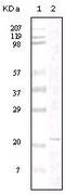 Protein Tyrosine Kinase 2 antibody, STJ98060, St John