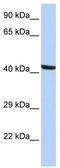Kaptin, Actin Binding Protein antibody, TA344318, Origene, Western Blot image 