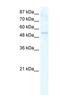 DEAD-Box Helicase 19A antibody, NBP1-57207, Novus Biologicals, Western Blot image 