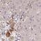 HGF Activator antibody, PA5-63654, Invitrogen Antibodies, Immunohistochemistry paraffin image 