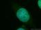 TSPY Like 2 antibody, 12087-2-AP, Proteintech Group, Immunofluorescence image 