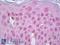 Vitamin D Receptor antibody, LS-B7259, Lifespan Biosciences, Immunohistochemistry paraffin image 