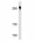 ROS Proto-Oncogene 1, Receptor Tyrosine Kinase antibody, F52830-0.4ML, NSJ Bioreagents, Western Blot image 