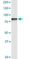 Stromal Interaction Molecule 1 antibody, LS-B4424, Lifespan Biosciences, Western Blot image 