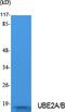 Ubiquitin Conjugating Enzyme E2 A antibody, A05264, Boster Biological Technology, Western Blot image 