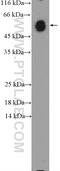 Immunoglobulin Heavy Constant Alpha 1 antibody, 11449-1-AP, Proteintech Group, Western Blot image 