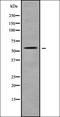 Solute Carrier Family 22 Member 17 antibody, orb338084, Biorbyt, Western Blot image 