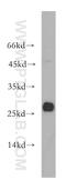 Glutathione S-Transferase Omega 1 antibody, 15124-1-AP, Proteintech Group, Western Blot image 