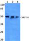 Cytochrome P450 Family 27 Subfamily A Member 1 antibody, PA5-75271, Invitrogen Antibodies, Western Blot image 