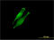Dolichyl-Diphosphooligosaccharide--Protein Glycosyltransferase Non-Catalytic Subunit antibody, LS-C197036, Lifespan Biosciences, Immunofluorescence image 