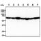 Apoptosis Inducing Factor Mitochondria Associated 1 antibody, GTX57664, GeneTex, Western Blot image 