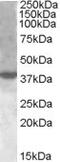 Activation Induced Cytidine Deaminase antibody, 45-218, ProSci, Western Blot image 