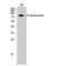 Phosphoinositide-3-Kinase Regulatory Subunit 1 antibody, LS-C385490, Lifespan Biosciences, Western Blot image 