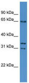 Copine 5 antibody, TA344749, Origene, Western Blot image 