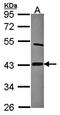 Interleukin 17 Receptor D antibody, orb69887, Biorbyt, Western Blot image 