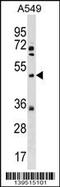 X-Linked Kx Blood Group antibody, 60-361, ProSci, Western Blot image 