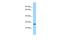 Coiled-Coil Domain Containing 28B antibody, A12327, Boster Biological Technology, Western Blot image 