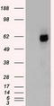 Checkpoint Kinase 2 antibody, CF500399, Origene, Western Blot image 