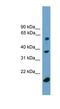 Transducin Beta Like 1 Y-Linked antibody, NBP1-79459, Novus Biologicals, Western Blot image 