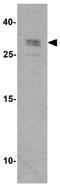RSPO3 antibody, GTX32155, GeneTex, Western Blot image 