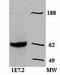 Zeta Chain Of T Cell Receptor Associated Protein Kinase 70 antibody, 14-6695-82, Invitrogen Antibodies, Western Blot image 