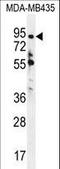 Zinc Finger Protein 605 antibody, LS-C160915, Lifespan Biosciences, Western Blot image 