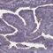 Nephrocystin 4 antibody, PA5-64227, Invitrogen Antibodies, Immunohistochemistry frozen image 